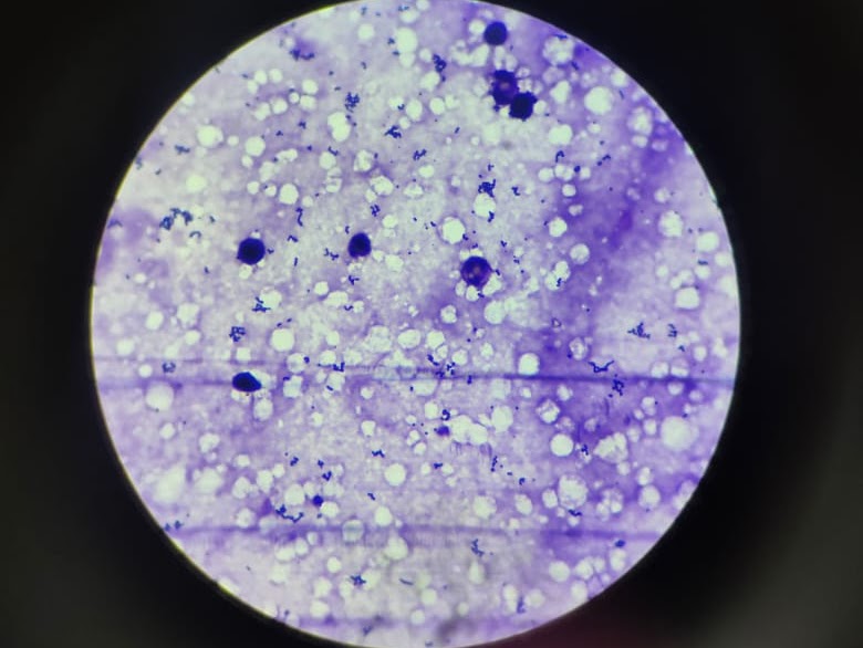 Microscope view — stained tissue + microbial cells under magnification